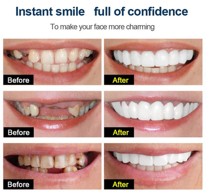 Snap on Smile teeth Cover